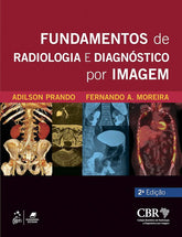 Fundamentos de Radiologia e Diagnóstico por Imagem Prando 2° Ed [E-book]