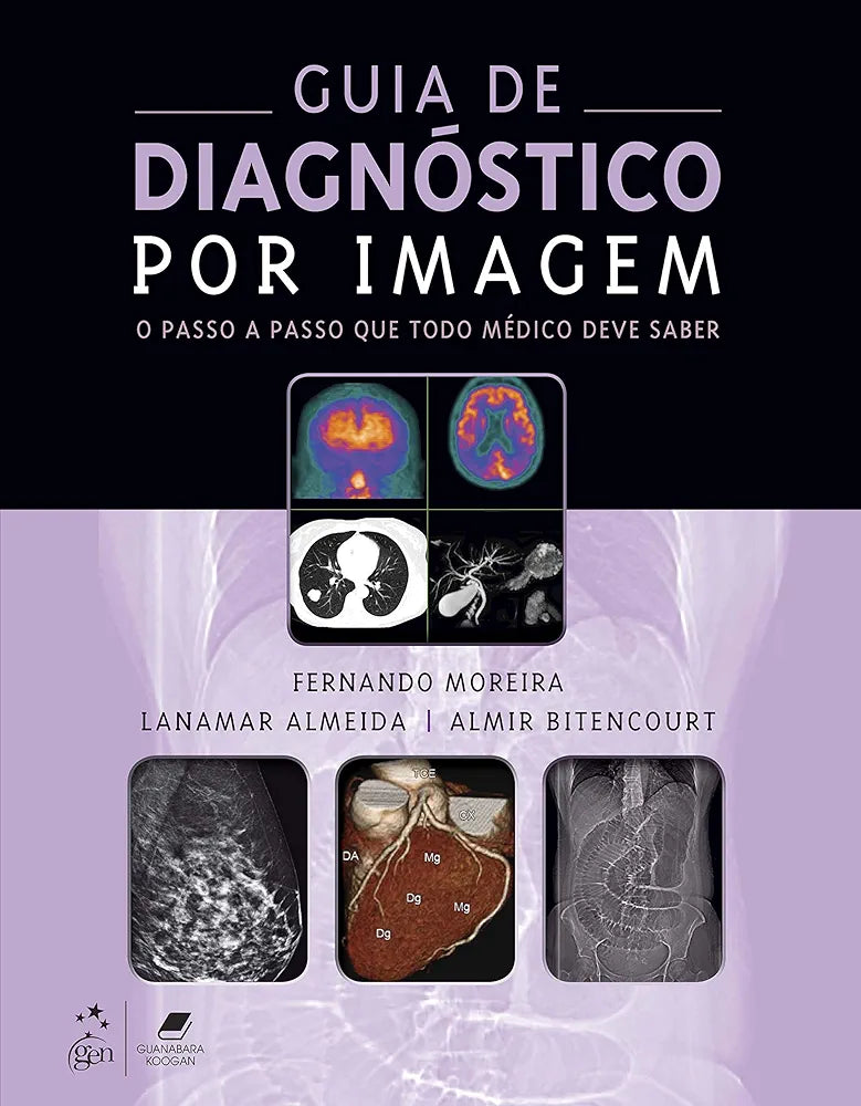 Guia do Diagnóstico por Imagem: o passo a passo que todo médico deve saber Moreira [E-book]