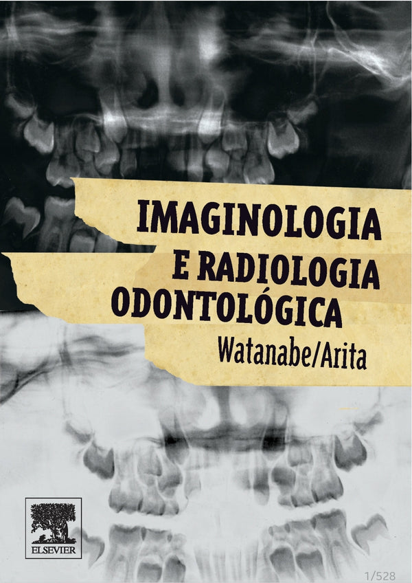 Imaginologia e Radiologia Odontológica Watanabe/Anita [E-book]