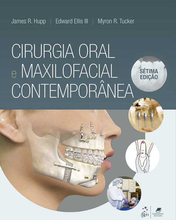 Cirurgia oral e Maxilofacial contemporânea Tucker 7° Ed [E-book]