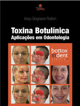 Toxina Botulínica - Aplicação em Odontologia Pedron [E-book]
