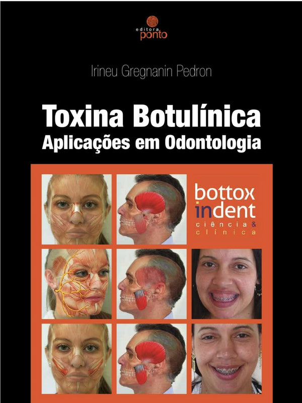 Toxina Botulínica - Aplicação em Odontologia Pedron [E-book]