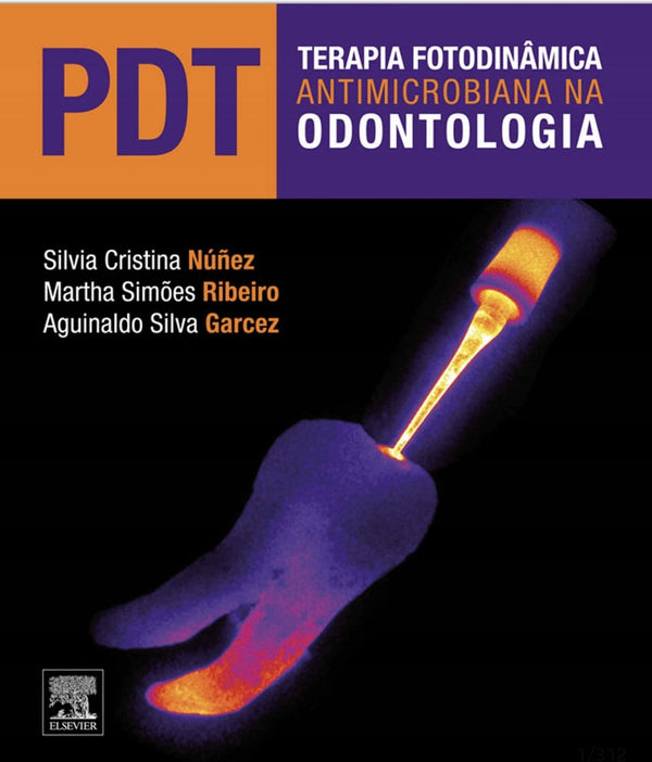 PDT - Terapia fotodinâmica antimicrobiana em Odontologia [E-book]