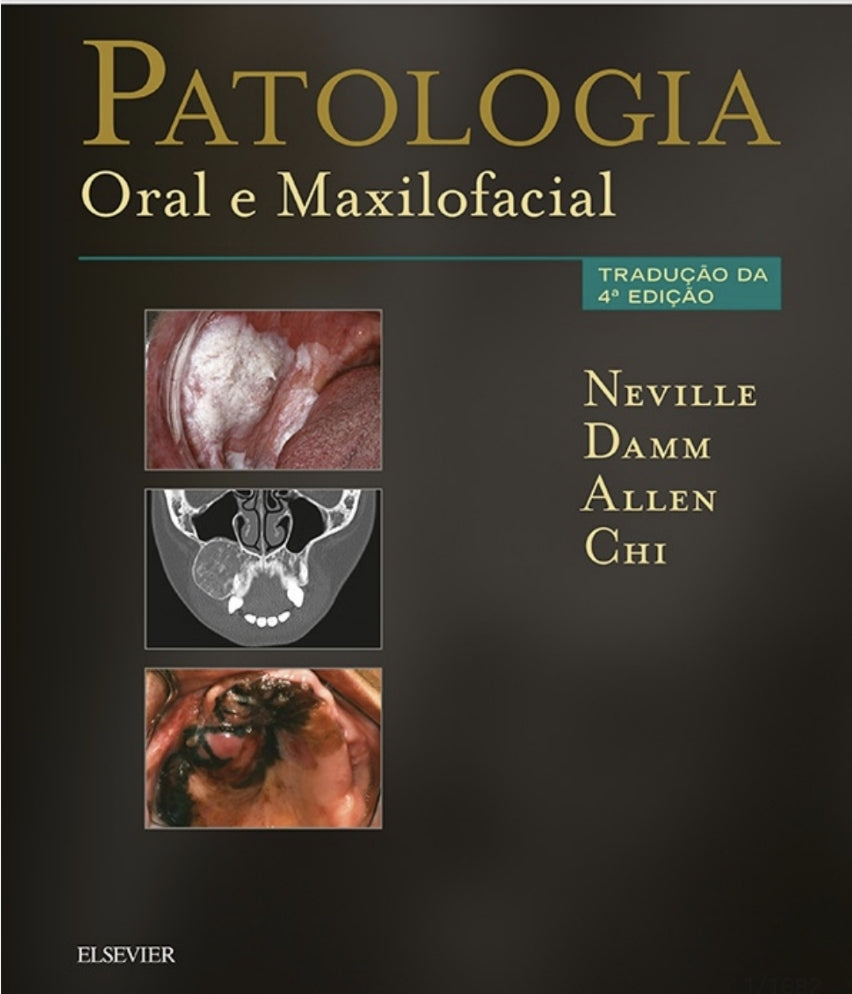 Patologia Oral e Maxilofacial Neville 4° Ed [E-book]