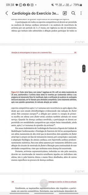 Cardiologia do Exercício: do atleta a cardiopatia Barreto e Negrão 3° Ed [E-book]