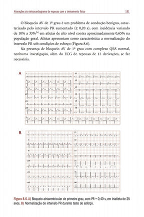 Cardiologia do Exercício: do atleta a cardiopatia Barreto e Negrão 3° Ed [E-book]
