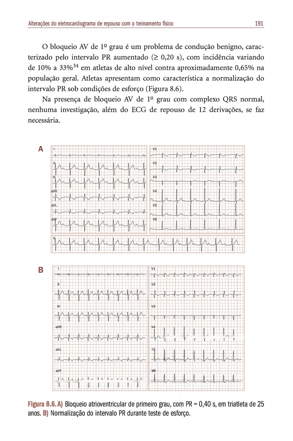 Cardiologia do Exercício: do atleta a cardiopatia Barreto e Negrão 3° Ed [E-book]