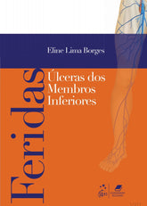 Feridas: Úlceras dos membros Inferiores Borges