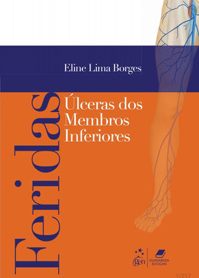Feridas: Úlceras dos membros Inferiores Borges