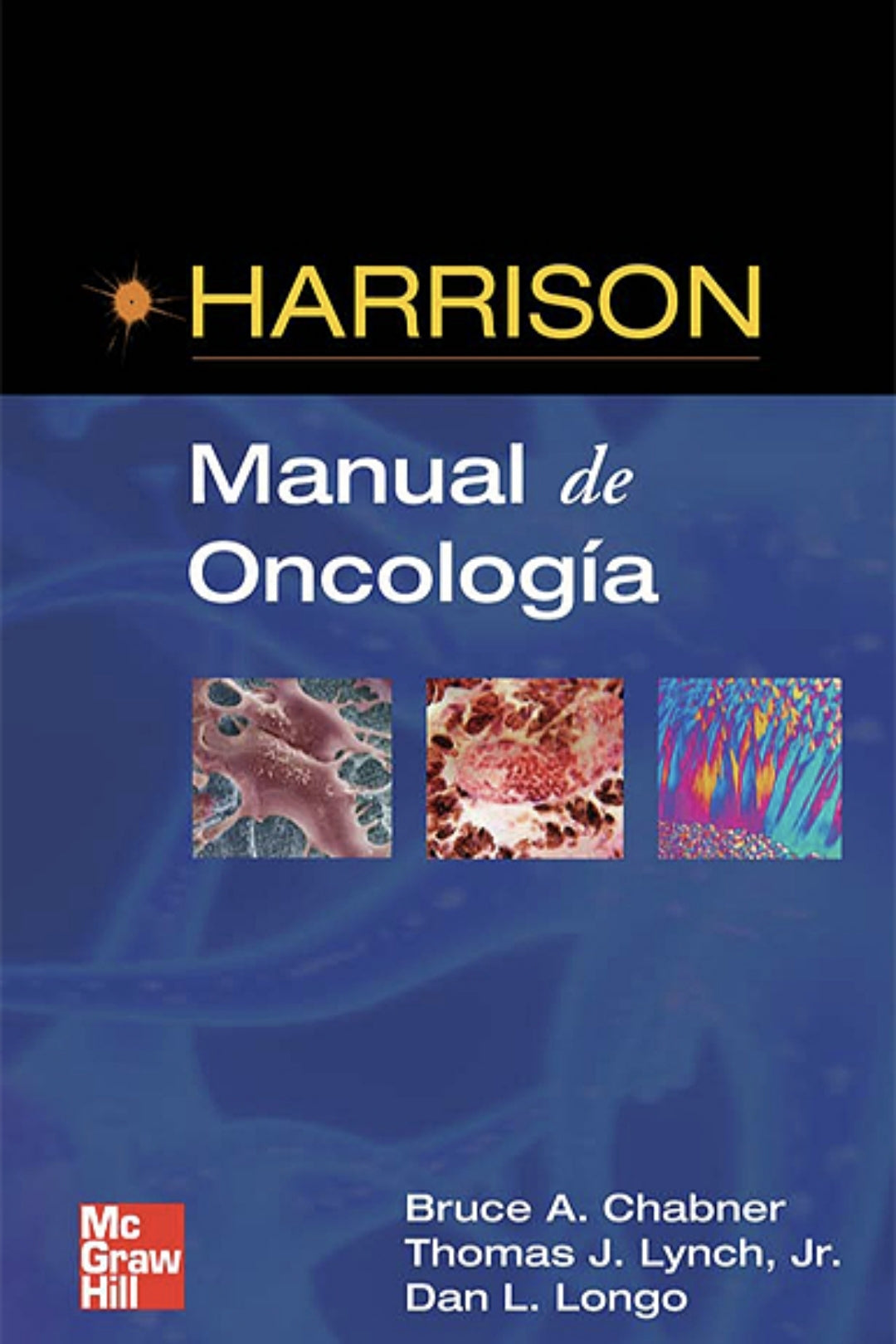 Harrison: Manual de Oncologia 1° Ed [E-book em Espanhol]