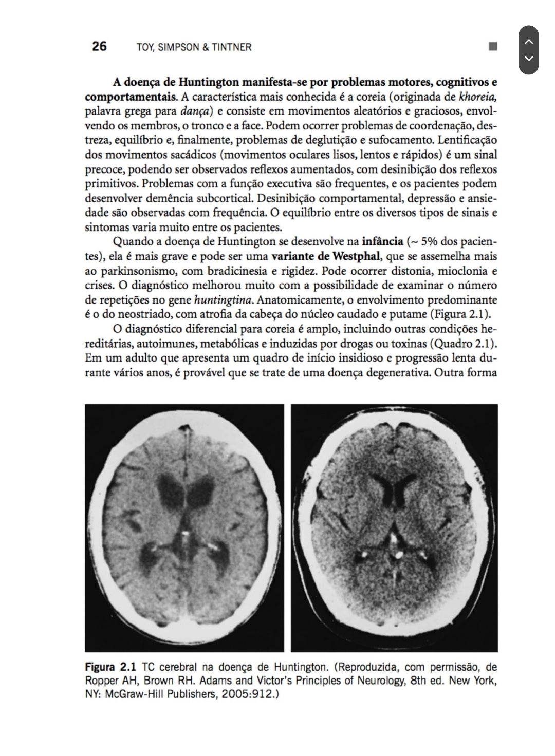 Casos Clínicos em Neurologia Toy 2° Ed [E-book]