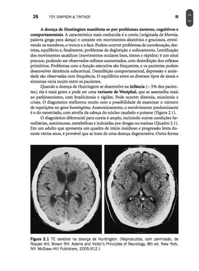 Casos Clínicos em Neurologia Toy 2° Ed [E-book]